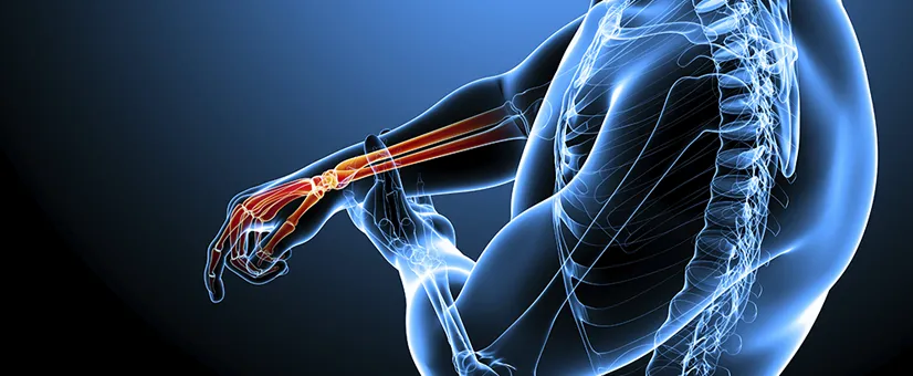 Orthopedics
